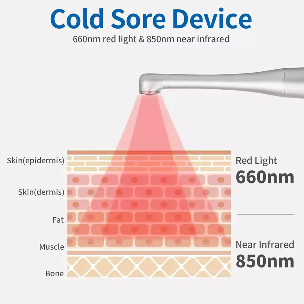 Red Light Therapy Wand Device •Treatment for Fever Blister, Canker Sore Mouth Sore Relief