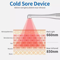 Thumbnail for Red Light Therapy Wand Device •Treatment for Fever Blister, Canker Sore Mouth Sore Relief