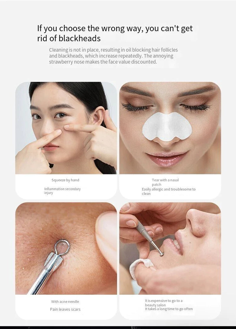 Professional Product Title: "Electric Blackhead Remover with Diamond Suction for Pore Cleansing"