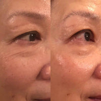 Thumbnail for Anti-Aging HIFU, EMS and Microcurrent 2.0, Skin Tightening, Anti-Aging, Lifting, Firming, Toning, Wrinkle Remover - Epic Trends and Gifts-Massager-Anti-Aging HIFU, EMS and Microcurrent 2.0, Skin Tightening, Anti-Aging, Lifting, Firming, Toning, Wrinkle Remover