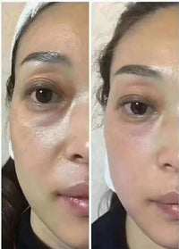 Thumbnail for Anti-Aging HIFU, EMS and Microcurrent 2.0, Skin Tightening, Anti-Aging, Lifting, Firming, Toning, Wrinkle Remover - Epic Trends and Gifts-Massager-Anti-Aging HIFU, EMS and Microcurrent 2.0, Skin Tightening, Anti-Aging, Lifting, Firming, Toning, Wrinkle Remover