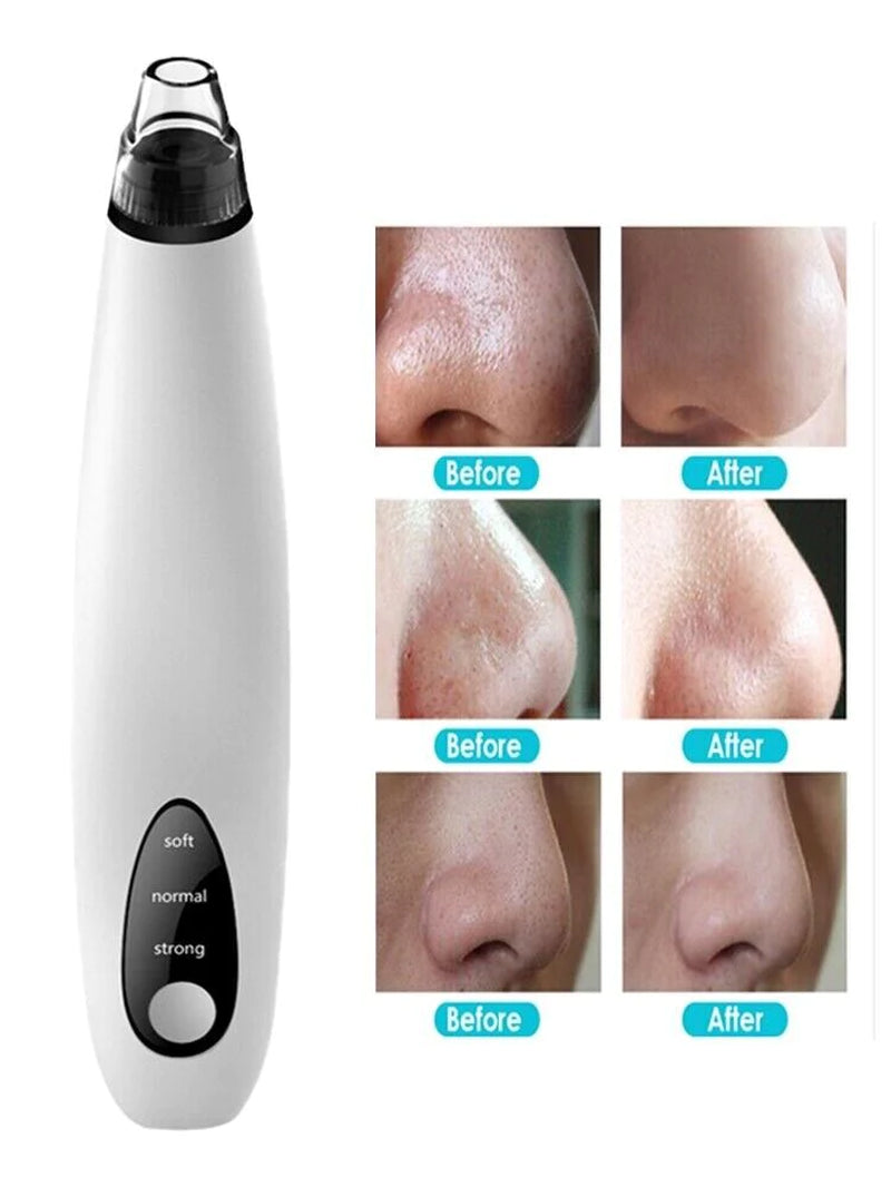 Professional Product Title: "Electric Blackhead Remover with Diamond Suction for Pore Cleansing"