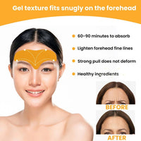 Thumbnail for Forehead Smoothie Patch - Epic Trends and Gifts-Anti Wrinkle Patch-Forehead Smoothie Patch