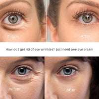 Thumbnail for New Anti-Wrinkle Eye Cream - Epic Trends and Gifts-Health & Beauty-New Anti-Wrinkle Eye Cream